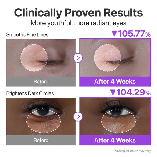 كريم لمحيط العين بالريتينول لدعم المرونة وتحسين الخطوط Numbuzin No.9 NAD Retinol Volumetox Eye Cream 10ml